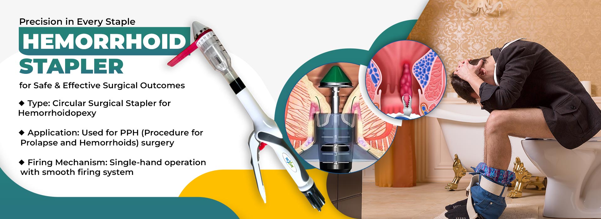 Smart Surgical Stapler for Piles Treatment